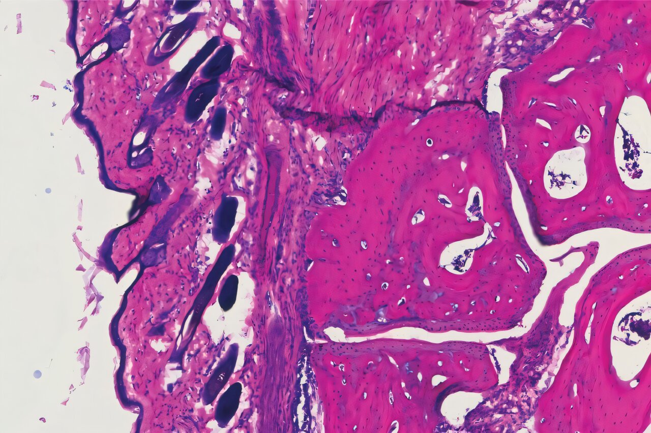 Novo anticorpo produzido em laboratório corresponde à eficácia da IVIG em doses mais baixas em camundongos