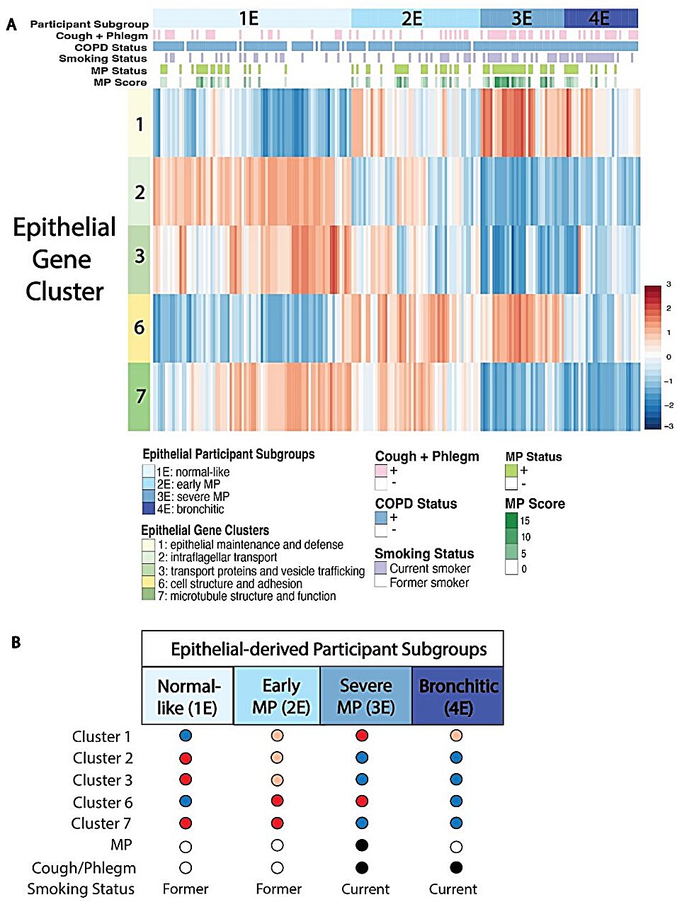 Novo estudo investiga o papel dos tampões mucosos na DPOC