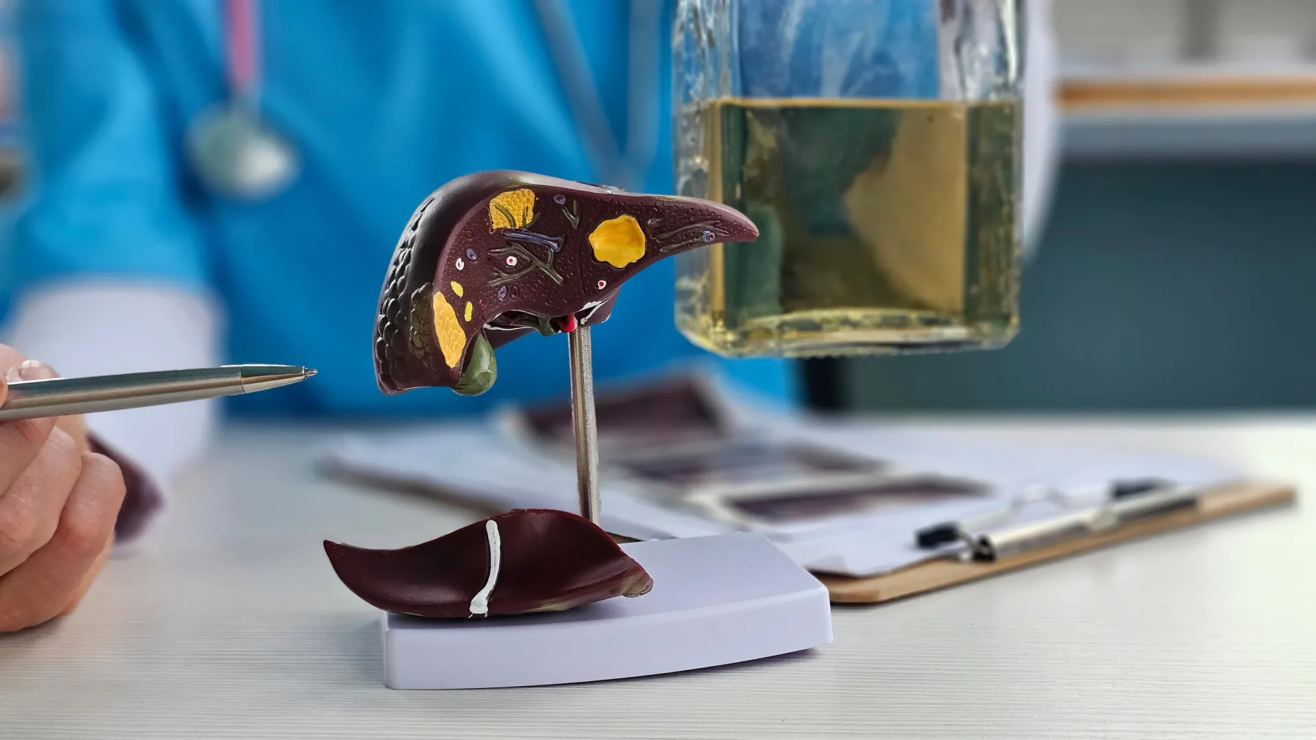 O bloqueio de uma enzima pode quebrar a ligação entre o álcool e a doença hepática