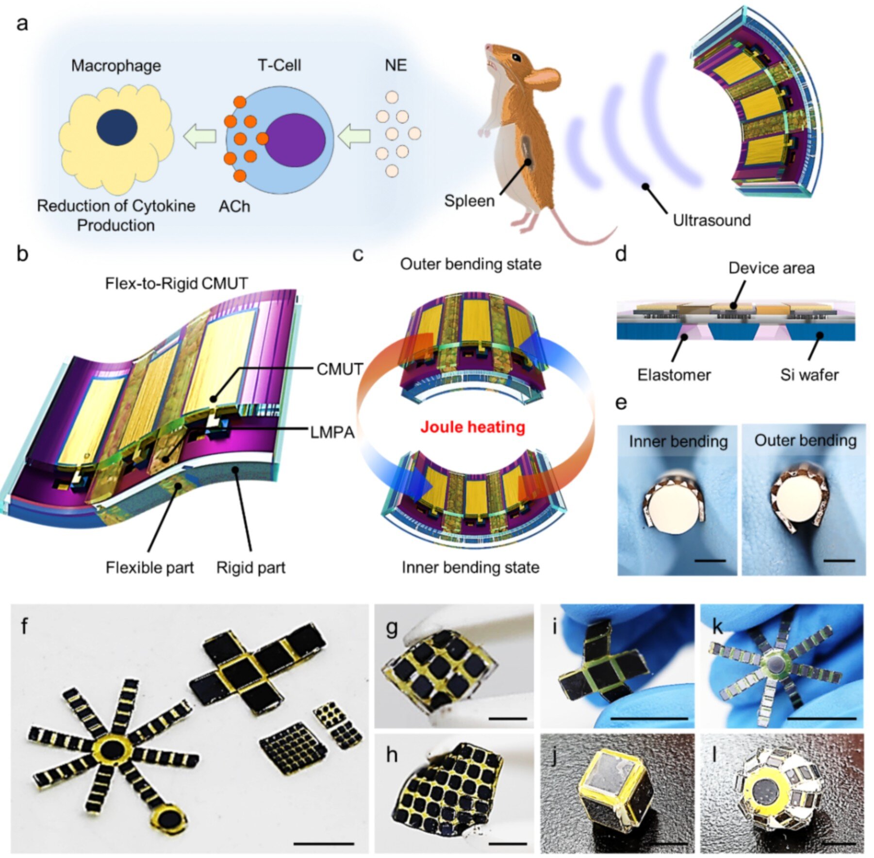 O sensor de ultrassom vestível oferece tratamento não invasivo com design ajustável e adaptado ao corpo