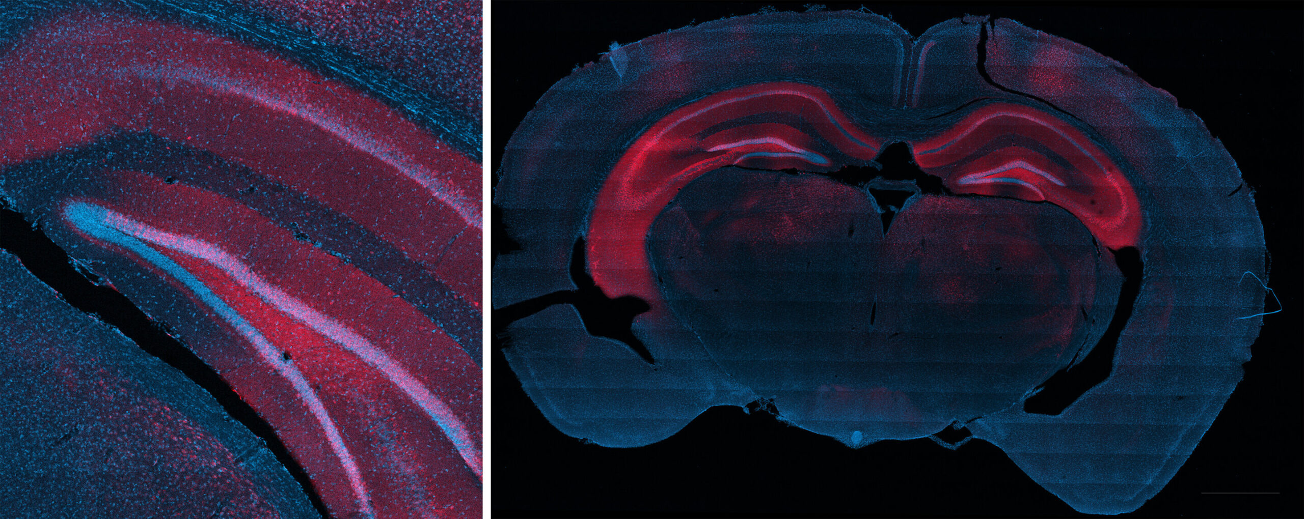 O tratamento não cirúrgico mostra-se promissor no controle direcionado de convulsões