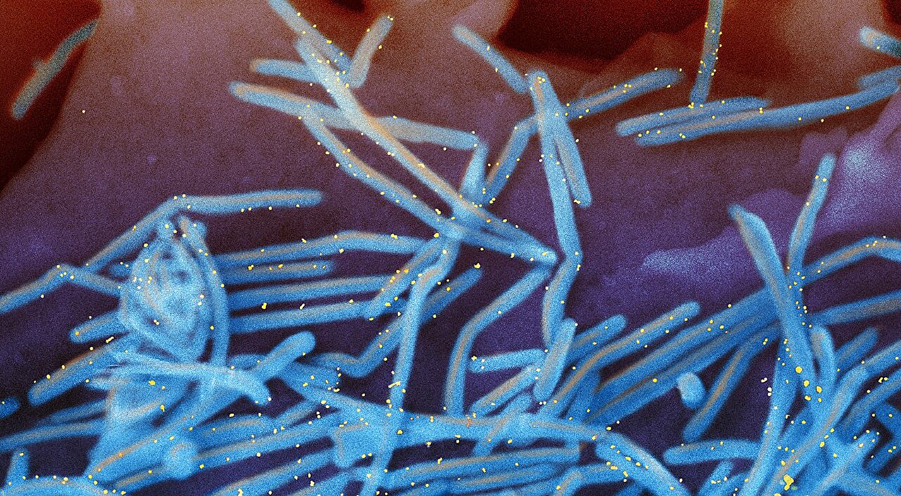 Protegendo bebês contra o vírus sincicial respiratório neste inverno – conselho emitido