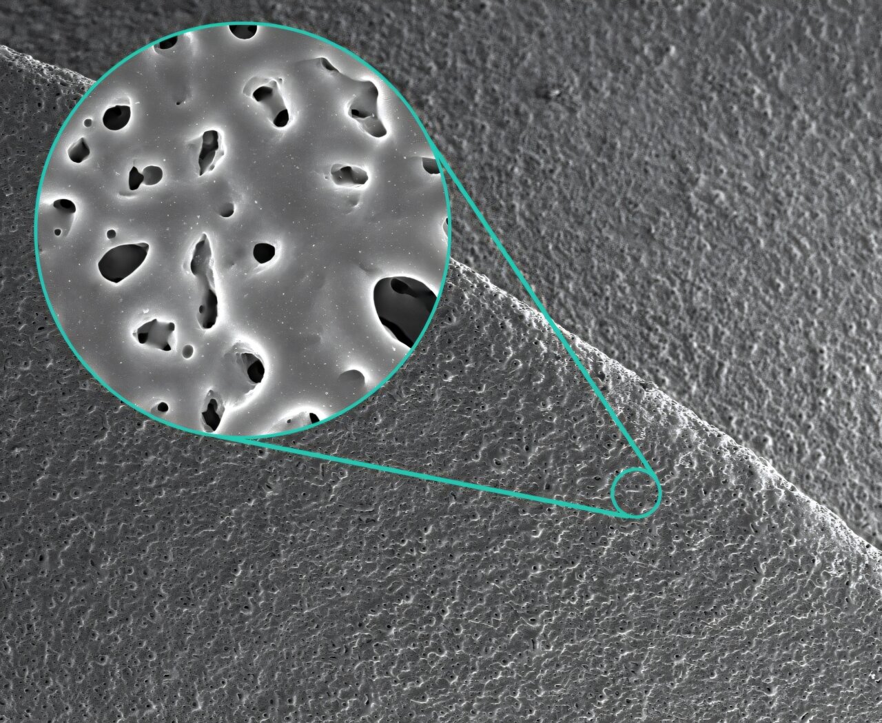 Superfícies inovadoras para carregar rapidamente implantes ósseos com antibióticos