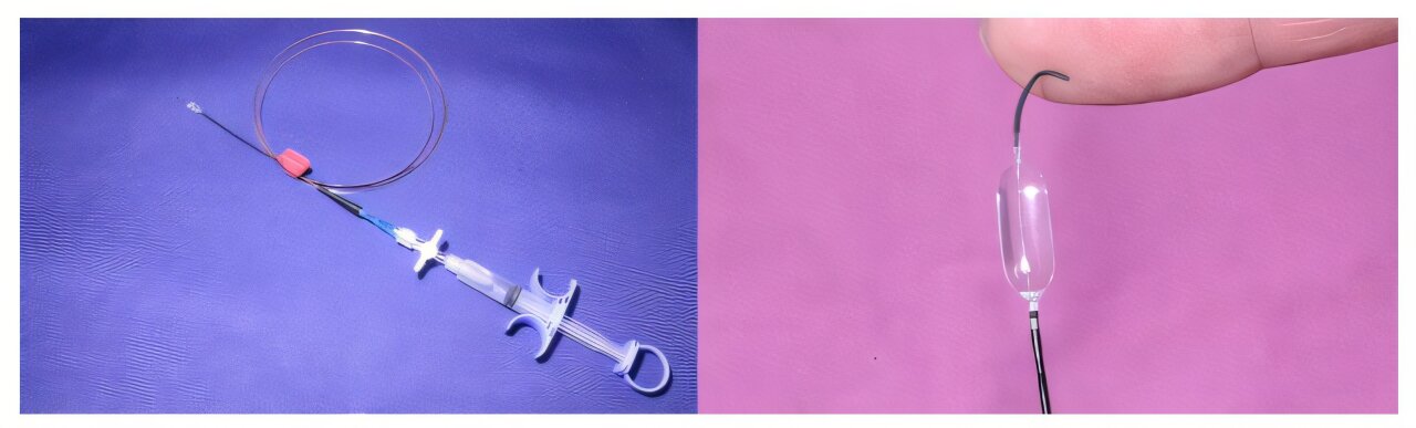 Técnica de endoscopia abre caminho para tumores pulmonares profundos