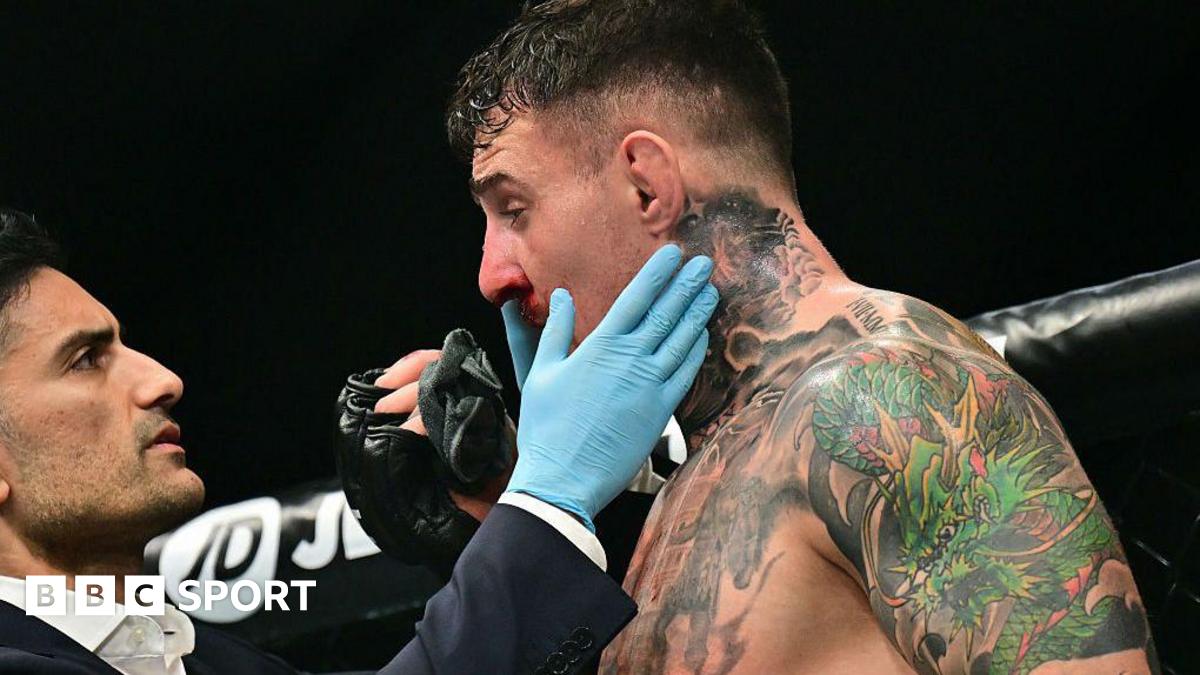 A doctor checks on Tom Aspinall's eye after an eye poke