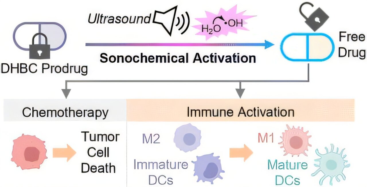 Transformando o tratamento do câncer com ultrassom
