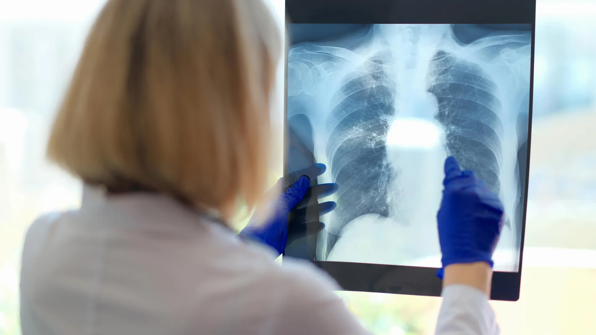 Um problema respiratório oculto pode estar por trás da exaustão esmagadora da fadiga crônica