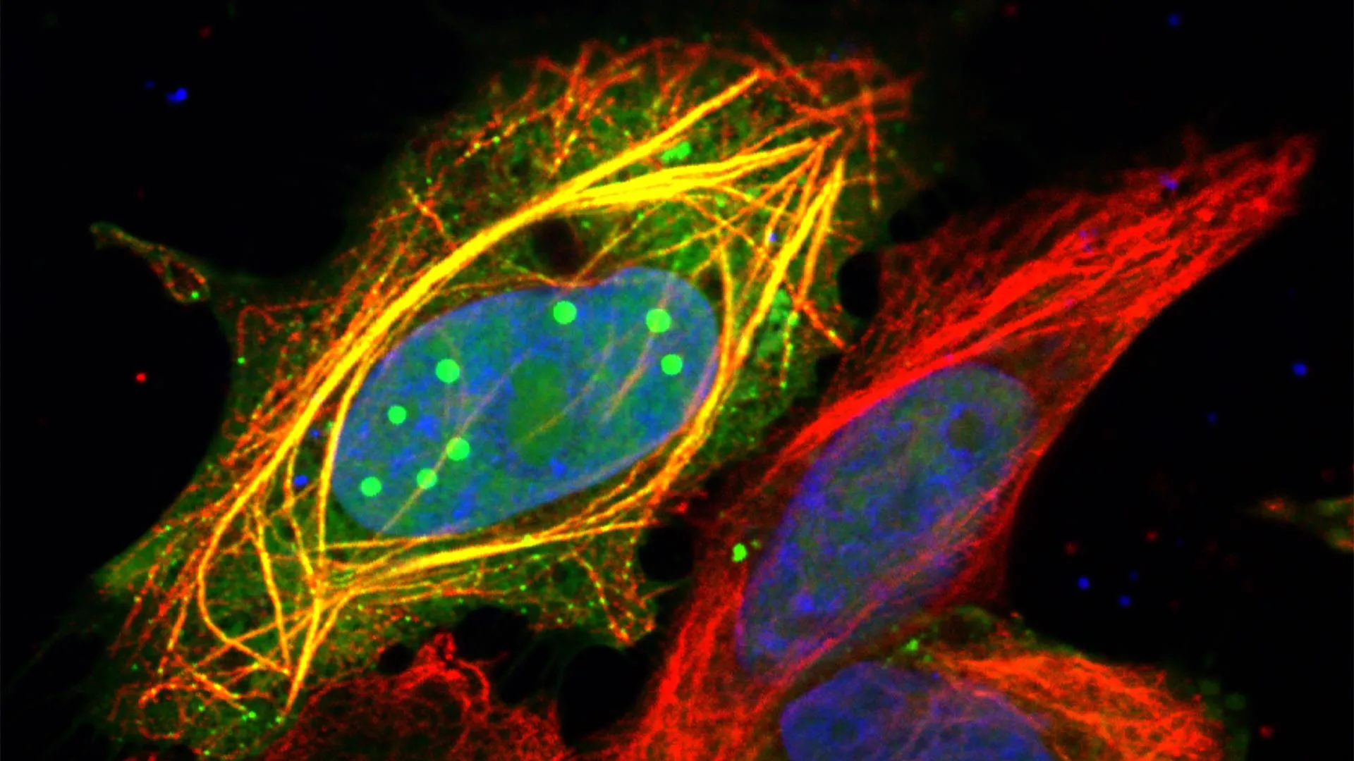 Uma proteína que muda de forma explica o poder mortal da raiva