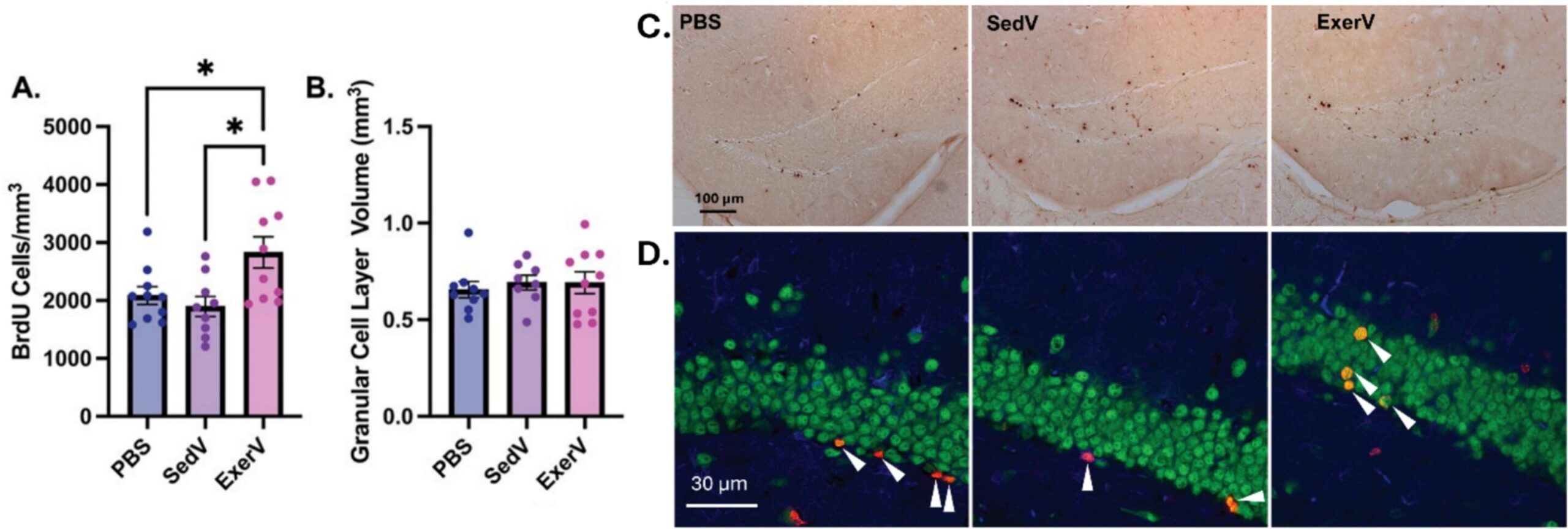 Vesículas induzidas por exercício aumentam o crescimento de neurônios quando transplantadas em camundongos sedentários