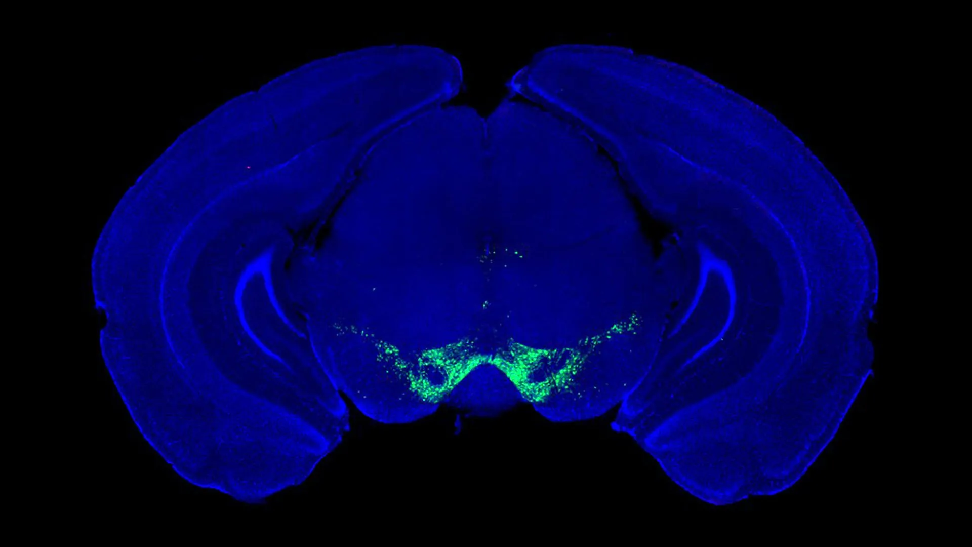 A descoberta de Parkinson muda o que sabemos sobre a dopamina