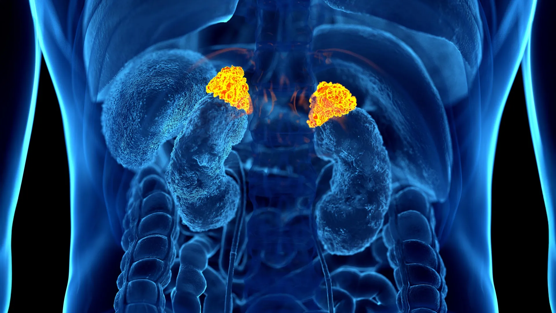 AI encontra um sinal de estresse oculto em tomografias computadorizadas de rotina