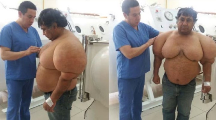 Acidente de mergulho estranho faz o corpo do homem inchar e os médicos não têm ideia de como consertar