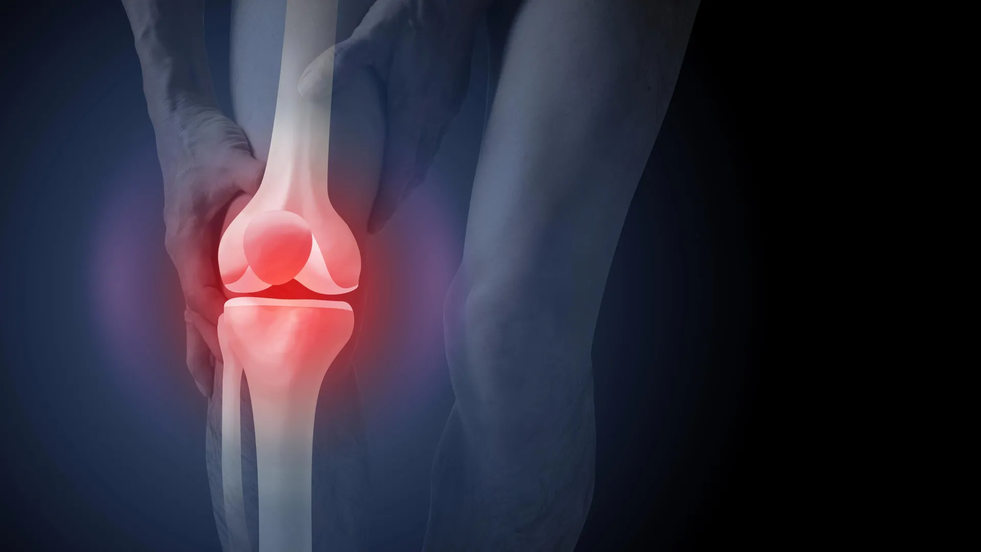Esponja de células-tronco para dor absorve a dor nas articulações da osteoartrite e protege a cartilagem