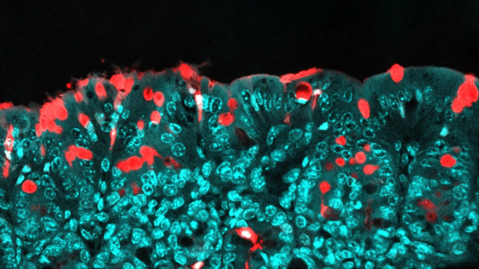 Este ingrediente alimentar comum pode moldar a saúde de uma criança para o resto da vida