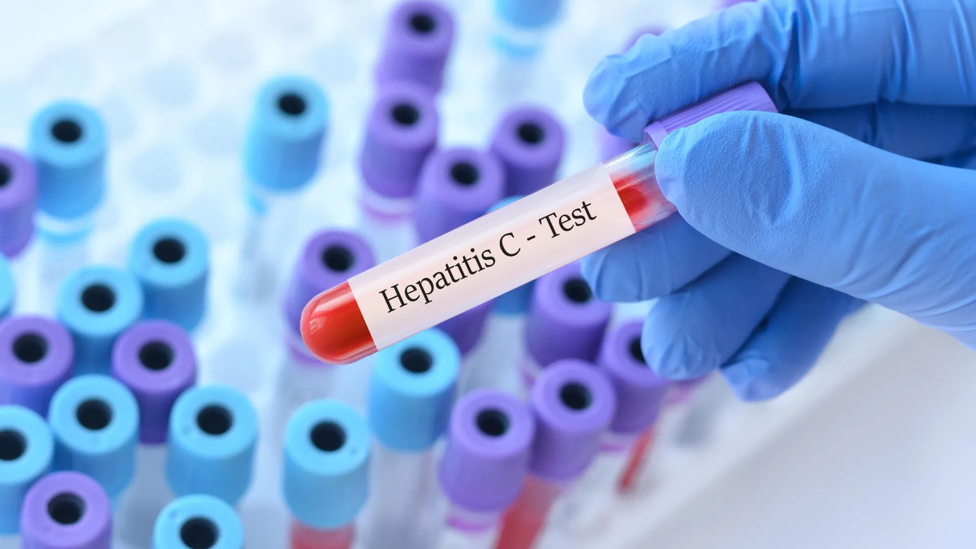 Este teste de hepatite C de 15 minutos pode mudar tudo