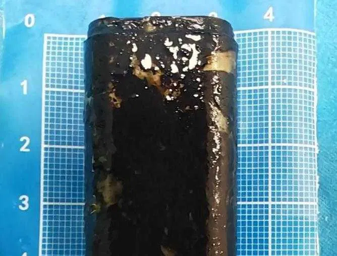 Homem chinês vive com isqueiro funcional no estômago há 30 anos