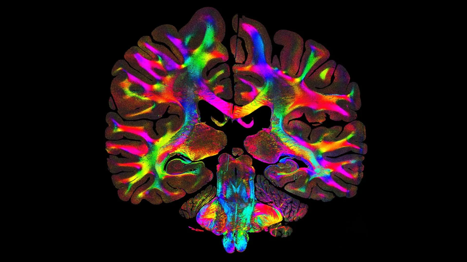 Truque simples de luz revela caminhos cerebrais ocultos em detalhes microscópicos