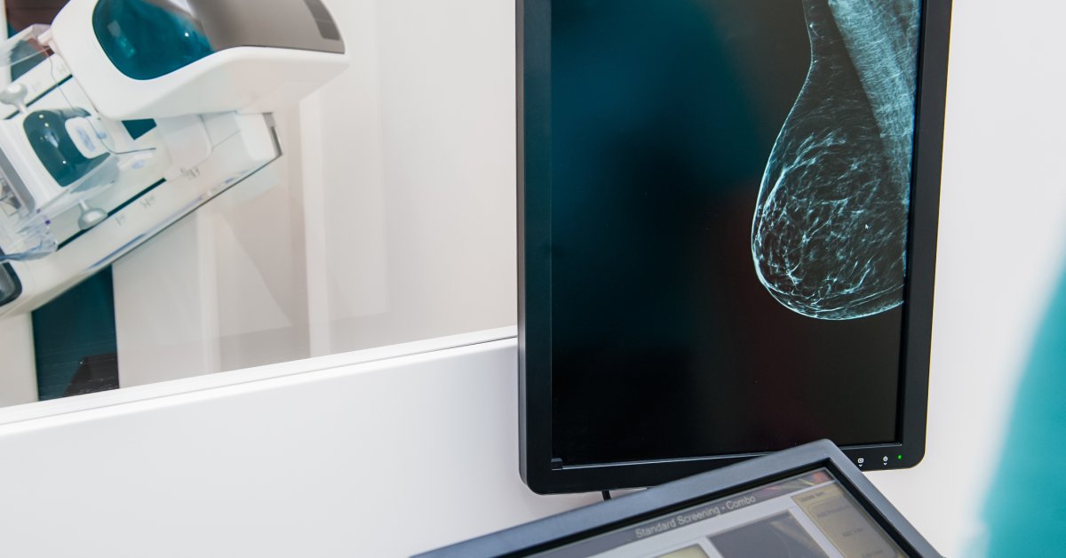 Um novo estudo desafia a forma como rastreamos o câncer de mama