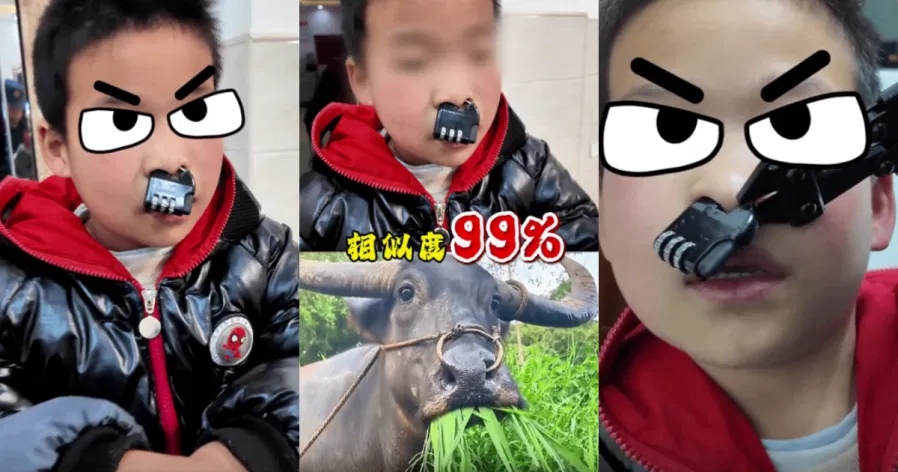 Criança travessa fica com bloqueio combinado preso no nariz