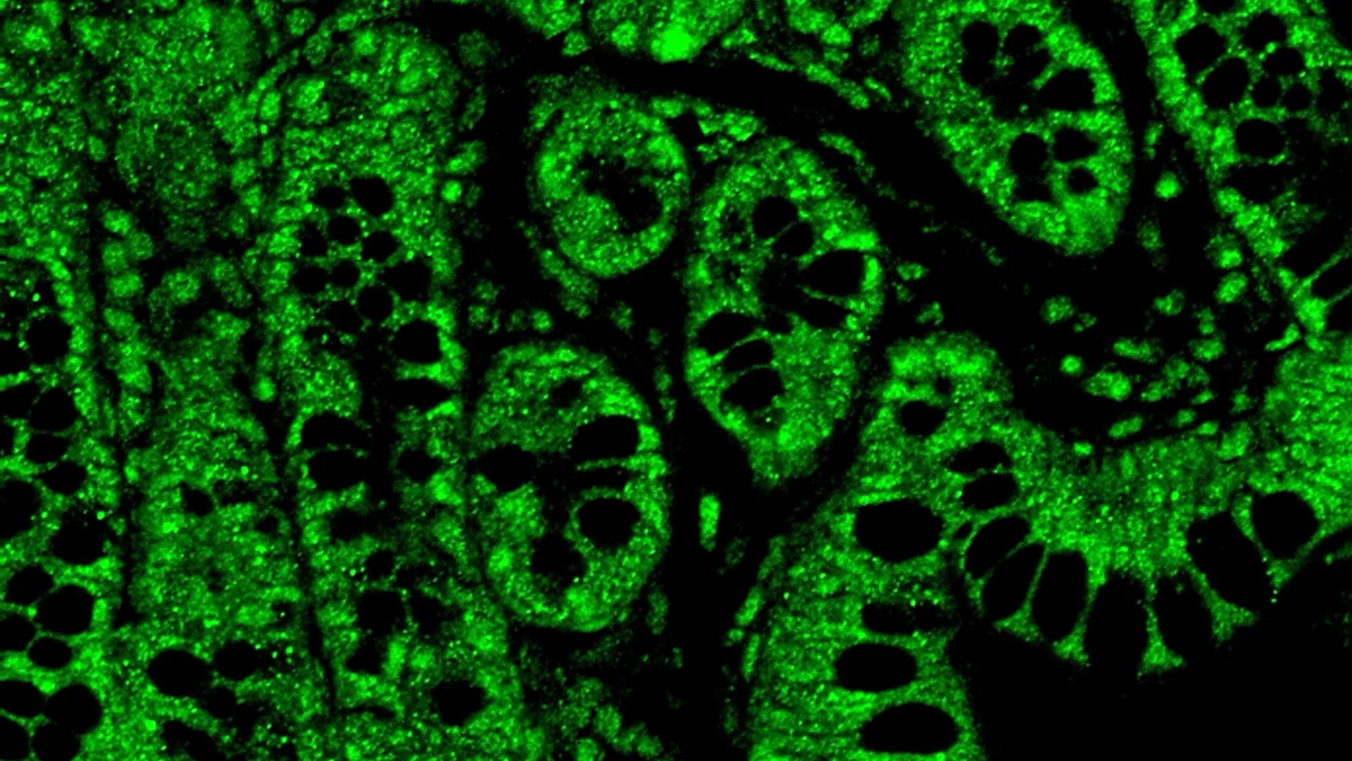 Pequenas doses de THC mostram grandes benefícios no tratamento do HIV