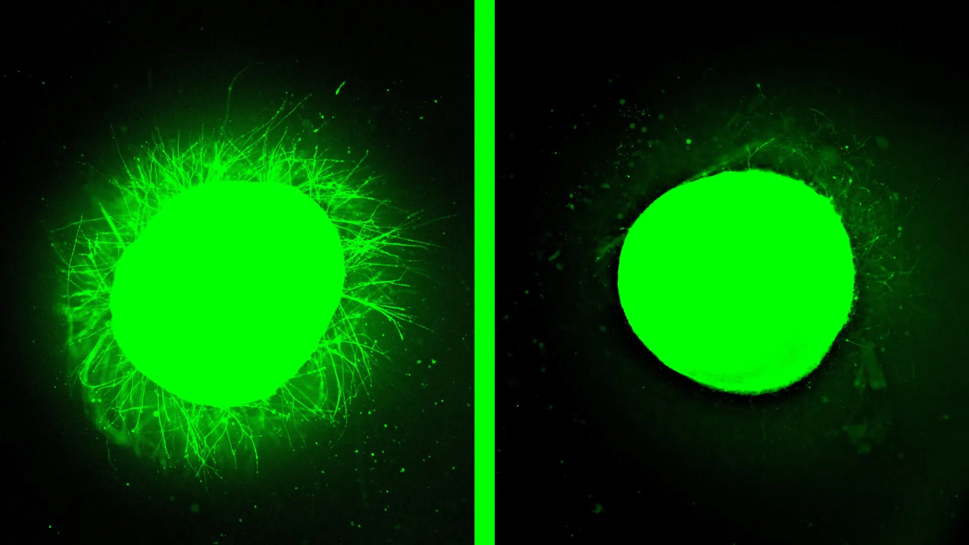 Medula espinhal humana cultivada em laboratório cura após lesão em grande avanço