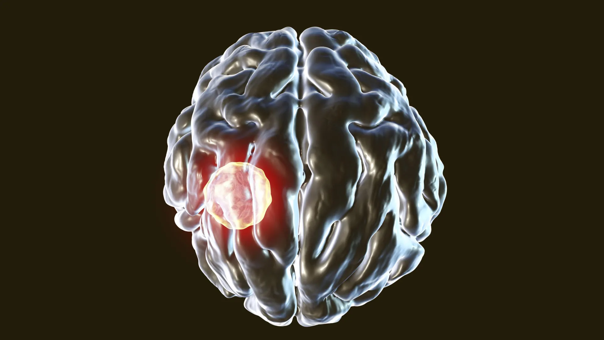 Uma em cada três pessoas carrega esse parasita cerebral, mas o corpo tem um interruptor para matar