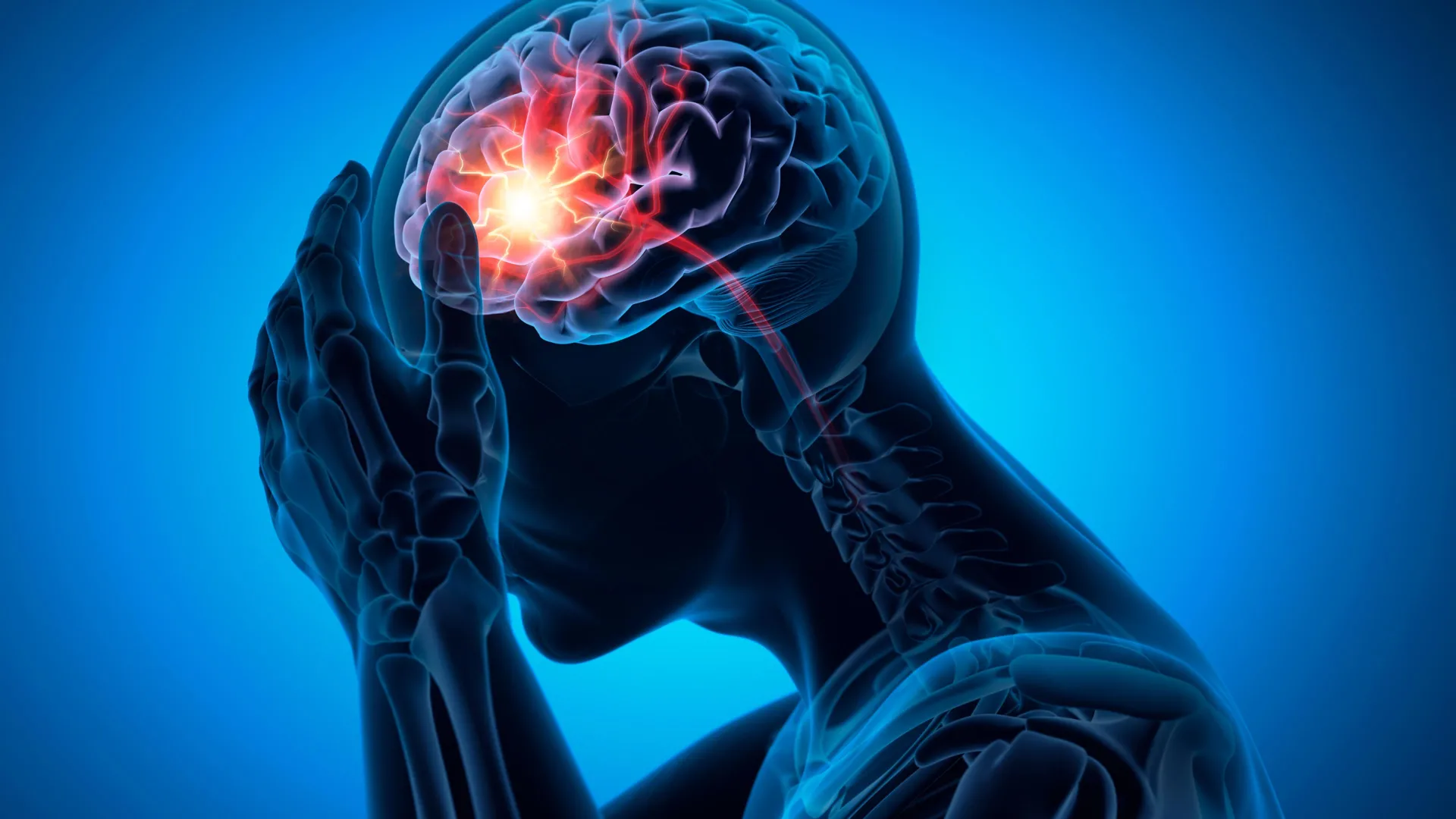 165.000 pacientes com demência revelam risco oculto de acidente vascular cerebral devido a medicamentos comuns