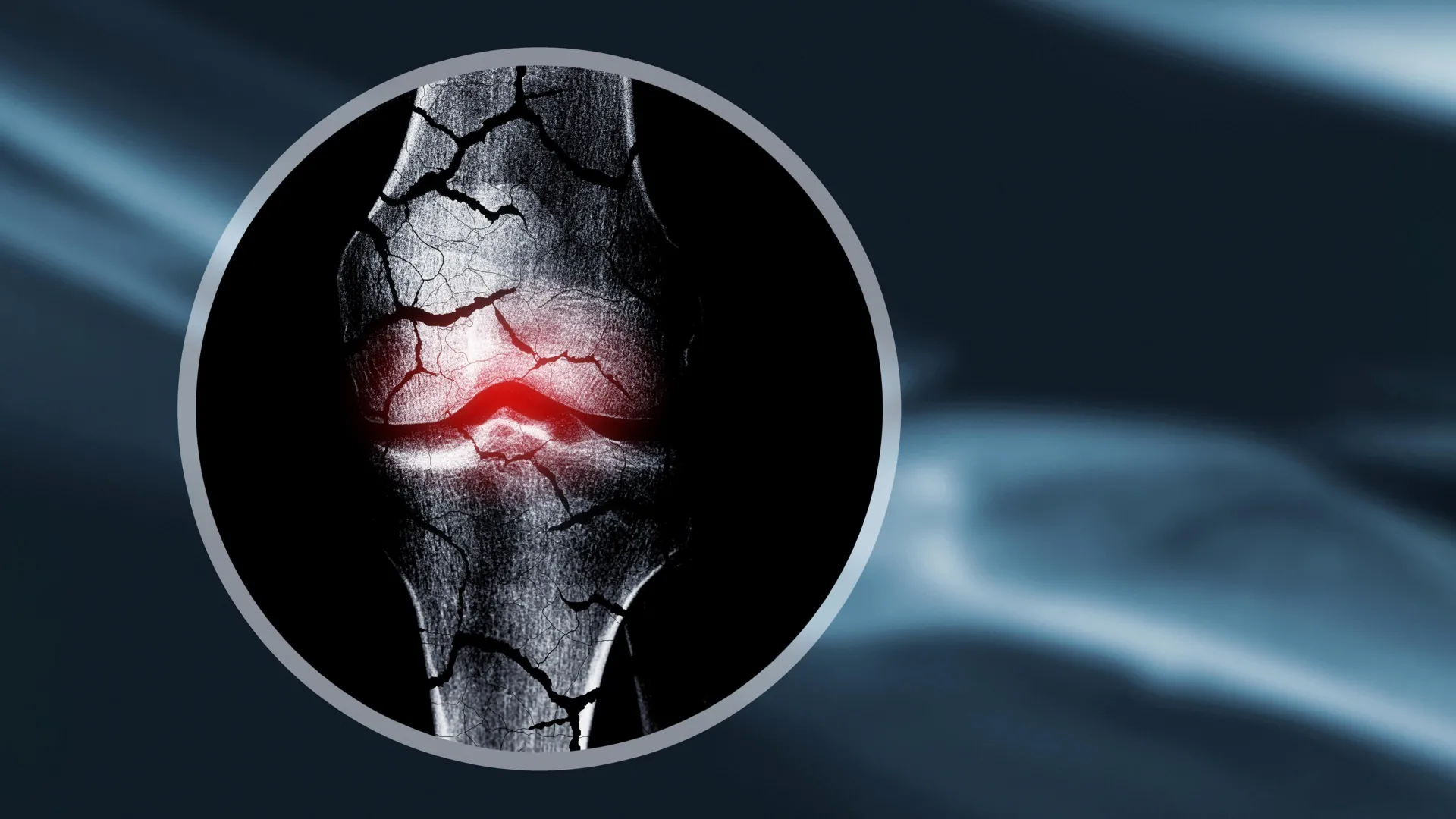 Cientistas criam estrutura de cartilagem que ajuda o corpo a regenerar ossos