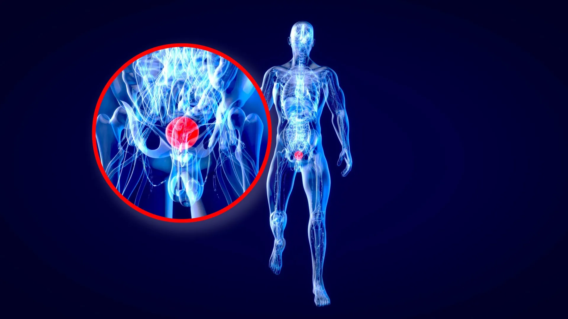 Cientistas de Stanford dizem que o daltonismo pode esconder um alerta mortal sobre câncer de bexiga