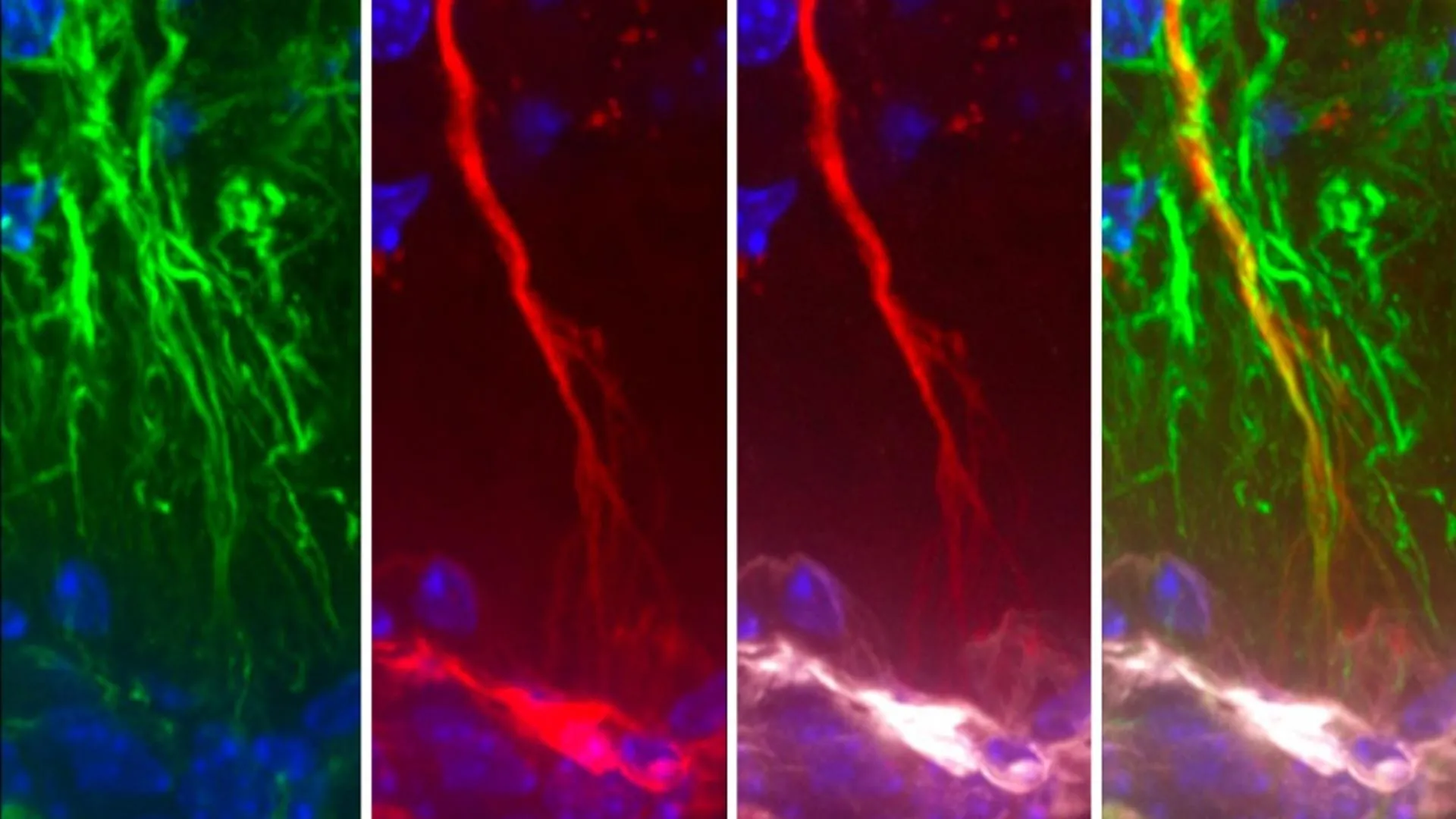 Cientistas descobrem células cerebrais ocultas que podem impedir o acúmulo de tau no Alzheimer