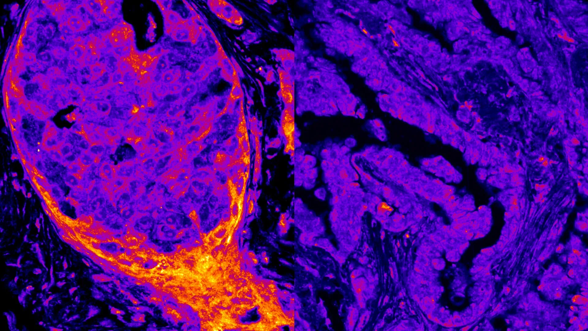 Metabolismo oculto encontrado operando dentro do núcleo da célula